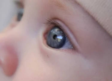 What Does a White Reflex in a Baby’s Eye Mean?