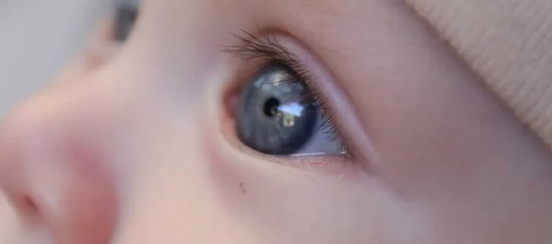What Does a White Reflex in a Baby’s Eye Mean?